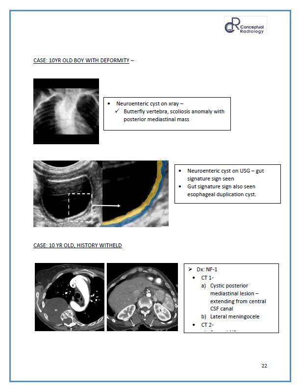 Mediastinal Algorithm In App Notes - Conceptual Radiology