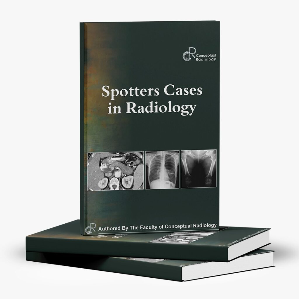 Radiology Books - Conceptual Radiology
